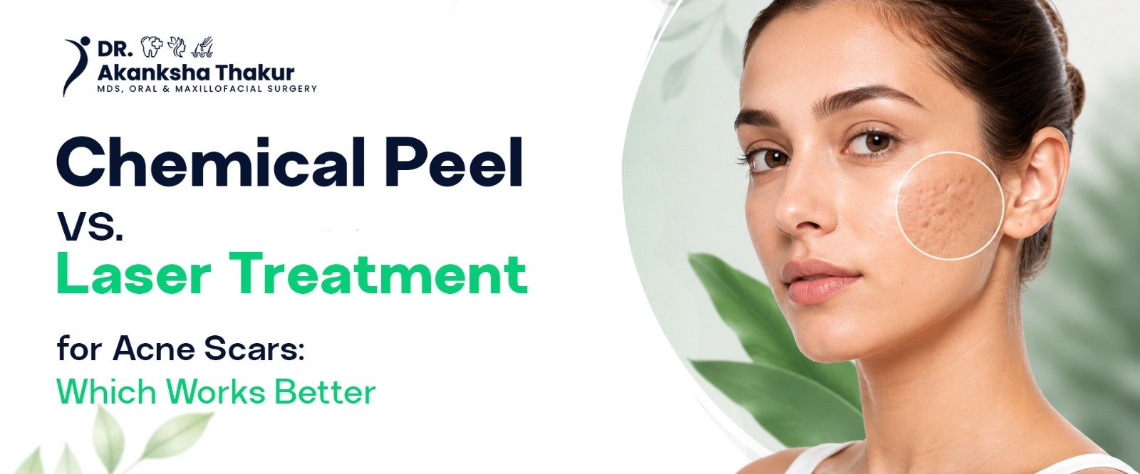 chemical-peel-vs-laser-treatment-acne-scars