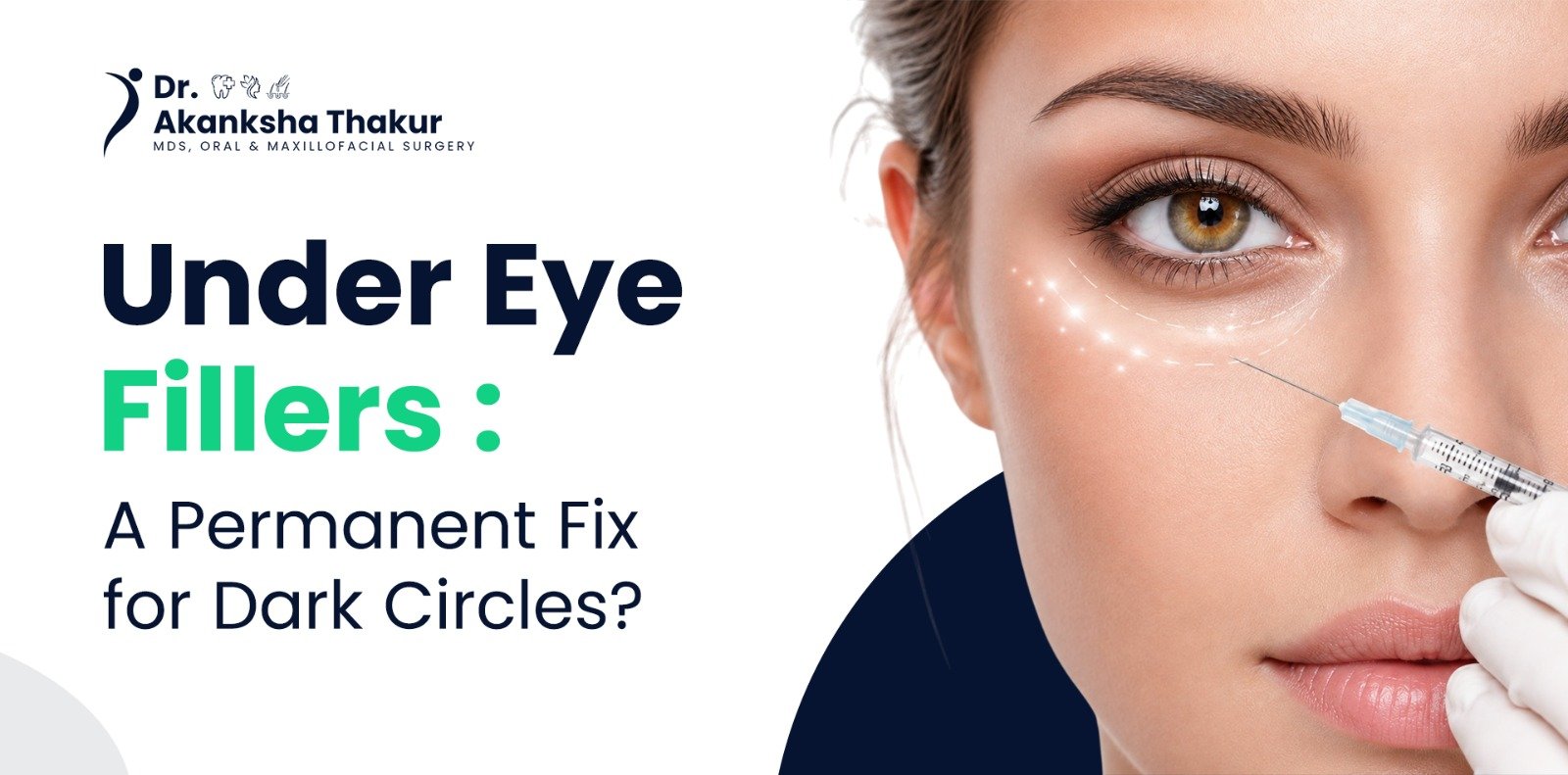 under eye fillers for dark circles