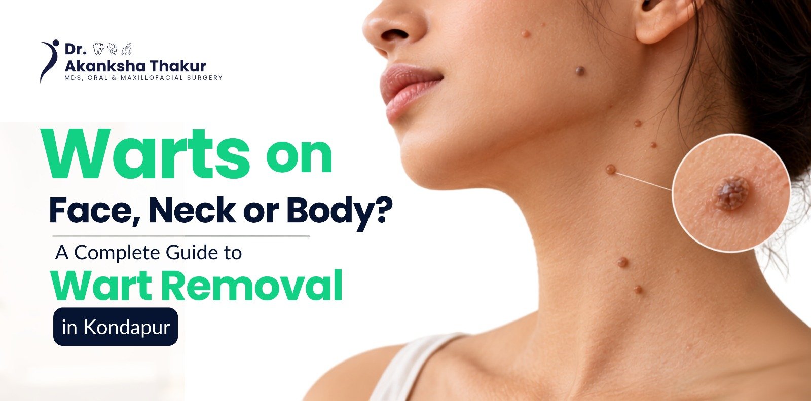 wart-removal-face-neck-body-kondapur-hyderabad